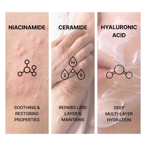 Intensive Moisturizing Cream for Extremely Dry Skin, Eczema Cream. Korean Skin Care, Anti-itch, Barrier repair. Niacinamide Cream, Hyaluronic Acid, Ceramide, Glycerin, Tocopherol.